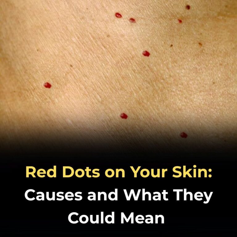 Red Dots on Your Skin: Causes and What They Could Mean