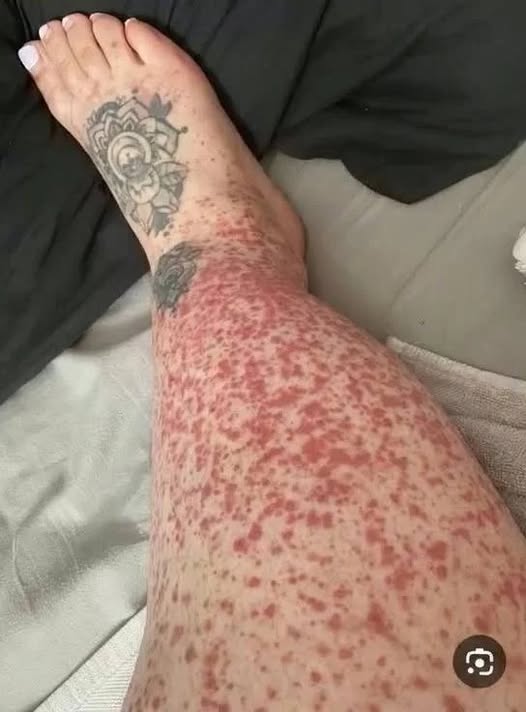 These are the repercussions of having sex with… View more