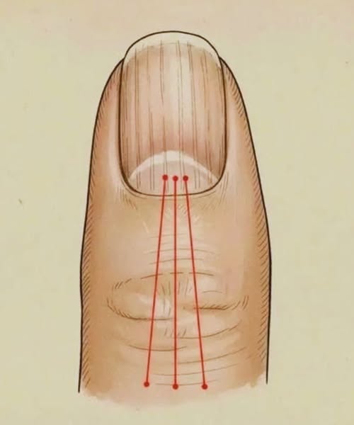 Nutrition for Stronger Nails: A Guide to Foods That Reduce Nail Ridges
