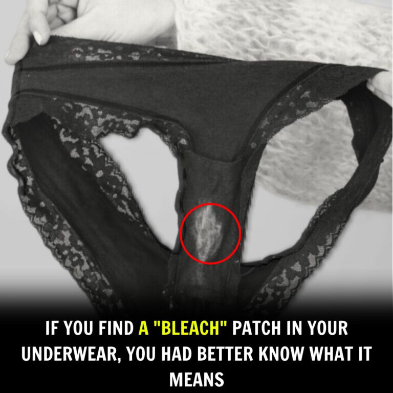 Why It Happens: The Science Behind the “Bleach” Effect