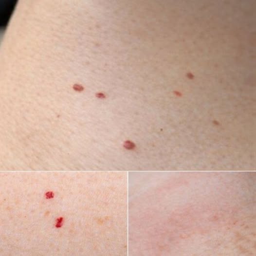 Red Dots on Your Skin: Possible Signs and Causes