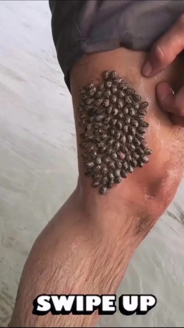 Why skin changes, such as redness or leg itching, can happen