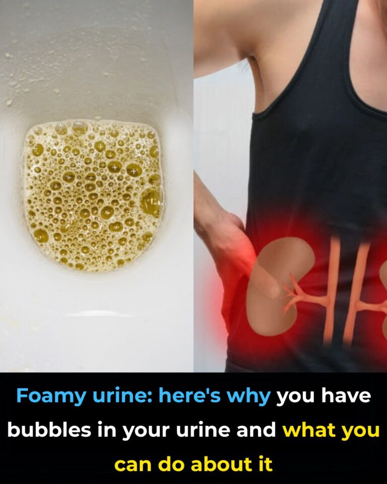 Foamy urine, often described as bubbly or frothy pee, is something many people notice from time to…