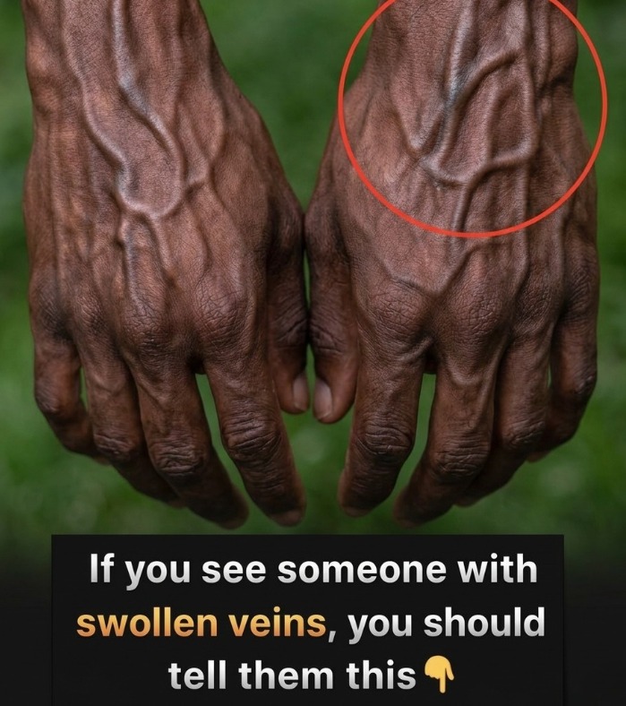 “The Hidden Clues in Your Hands: What the Veins Might Reveal About Your Heart Health, Leaving Experts and Everyday People Wondering What Signs Are Subtle, What Risks Lurk Unnoticed, and How Something as Simple as Looking at Your Own Hands Could Hold Secrets About Your Body That Few Ever Consider, Sparking Curiosity and Concern Worldwide”
