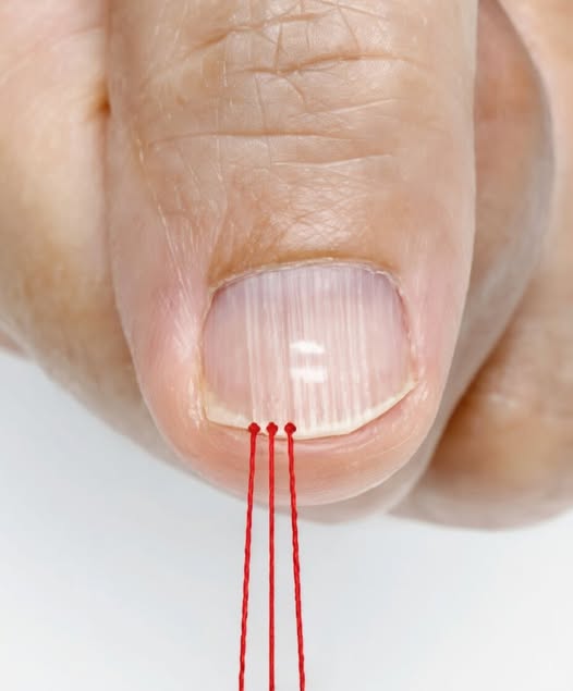 If you have these lines on your nails after 40, it is a clear sign that..