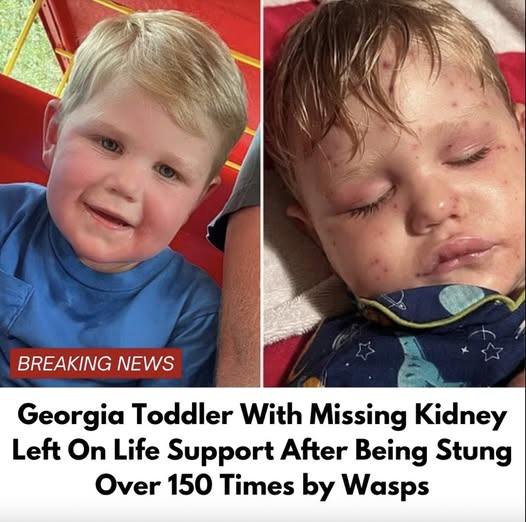 An Update on Beckham Reed’s Battle: Georgia Toddler Stung More Than 150 Times by Yellow Jackets, Now Fighting for His Life