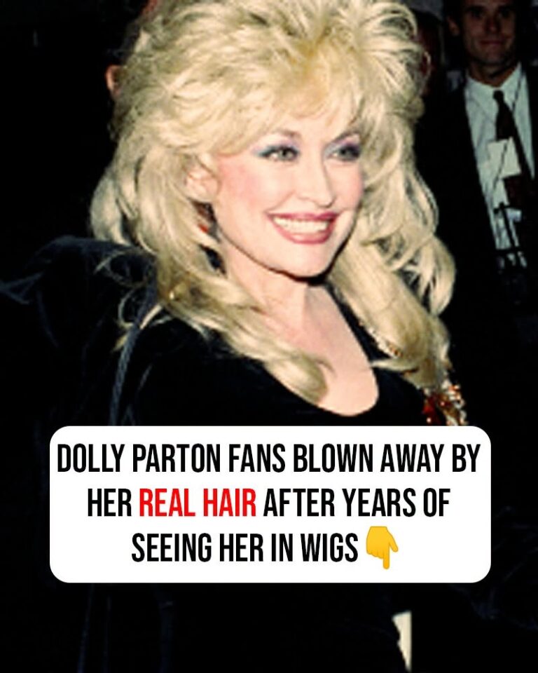 Dolly Parton fans blown away by her real hair after years of seeing her in wigs